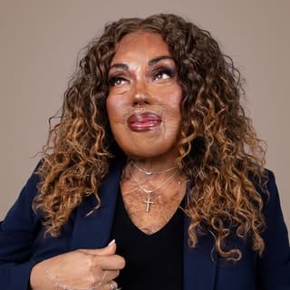 Burned Beauty 2018 ™️ | Tonya Renee Meisenbach, Beauty & Skincare influencer in Los Angeles