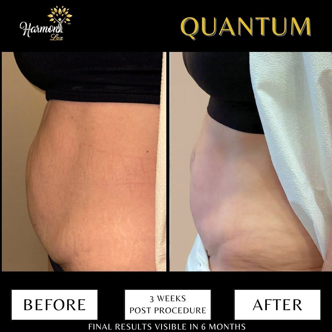 Post 4 by Harmony Lux Wellness Center on Instagram (image)