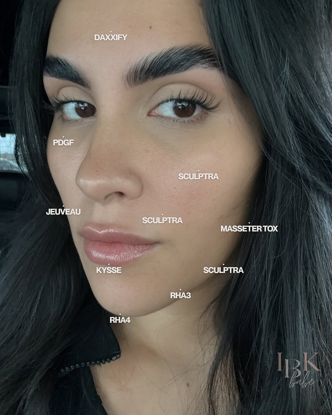 Post 8 by Houston Nurse Injector | Kristine Deal on Instagram (image)