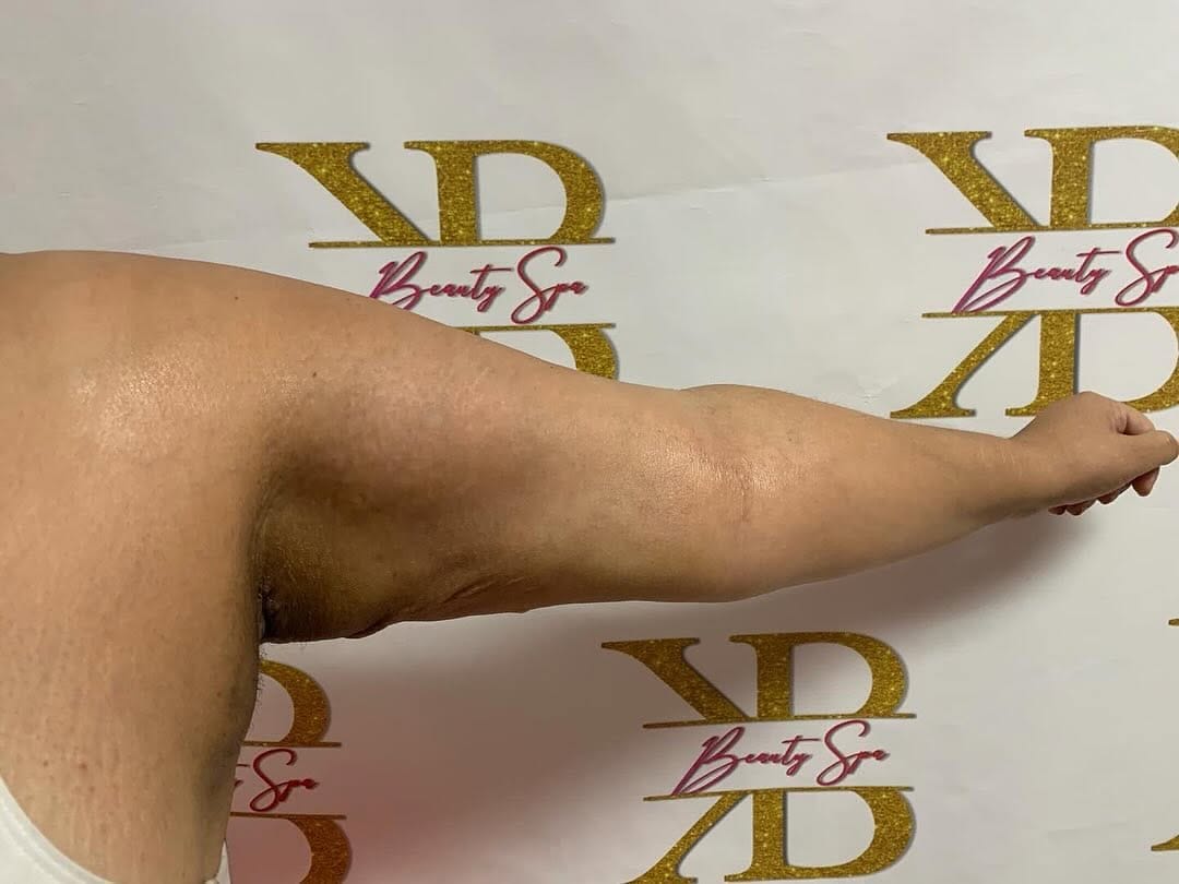 Post 2 by Houston’s #1 Body Sculpting on Instagram (carousel)