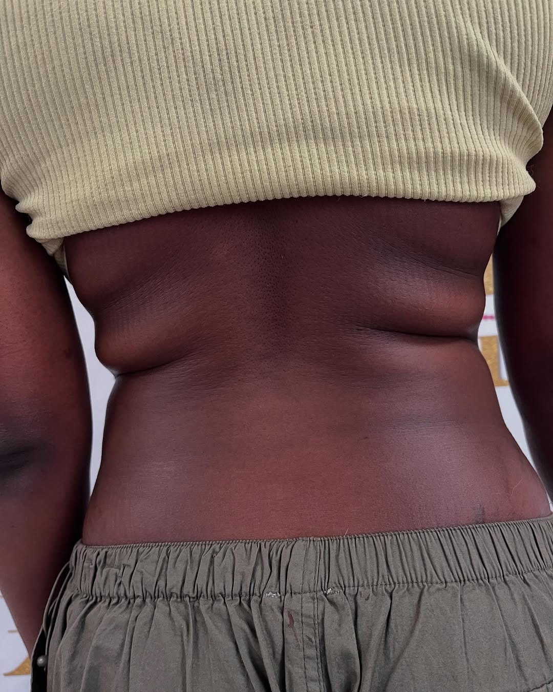Post 3 by Houston’s #1 Body Sculpting on Instagram (carousel)