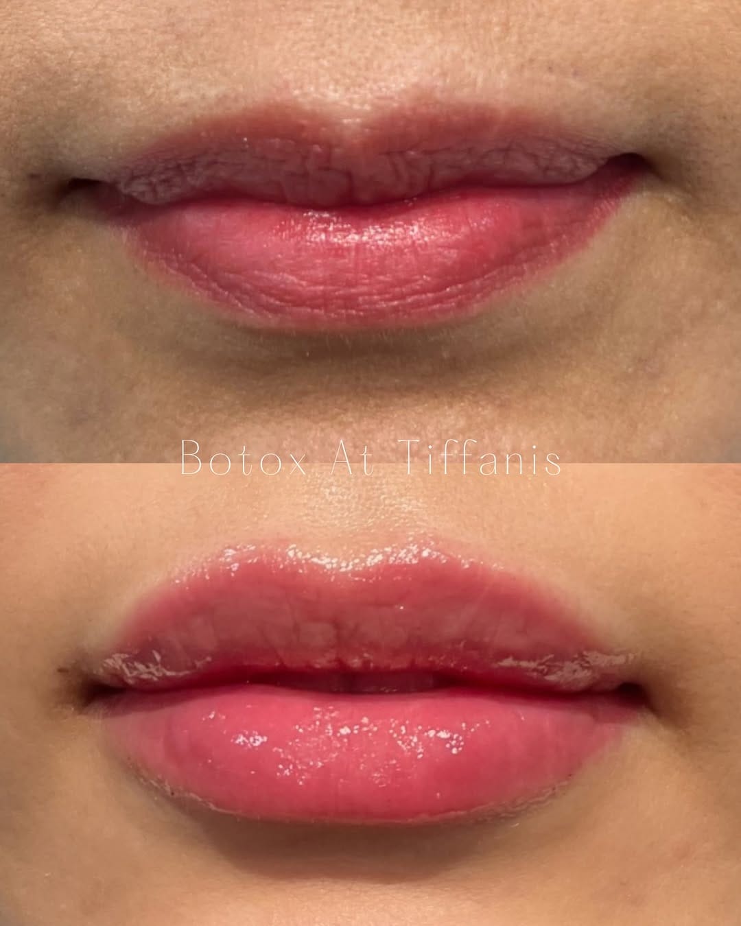 Post 3 by Tiffani Terrell, RN Injector  💋 on Instagram (image)