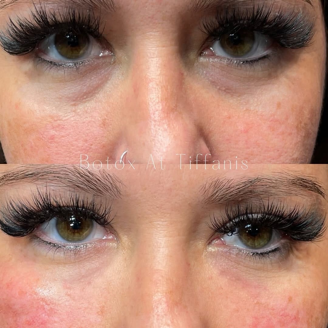 Post 10 by Tiffani Terrell, RN Injector  💋 on Instagram (image)