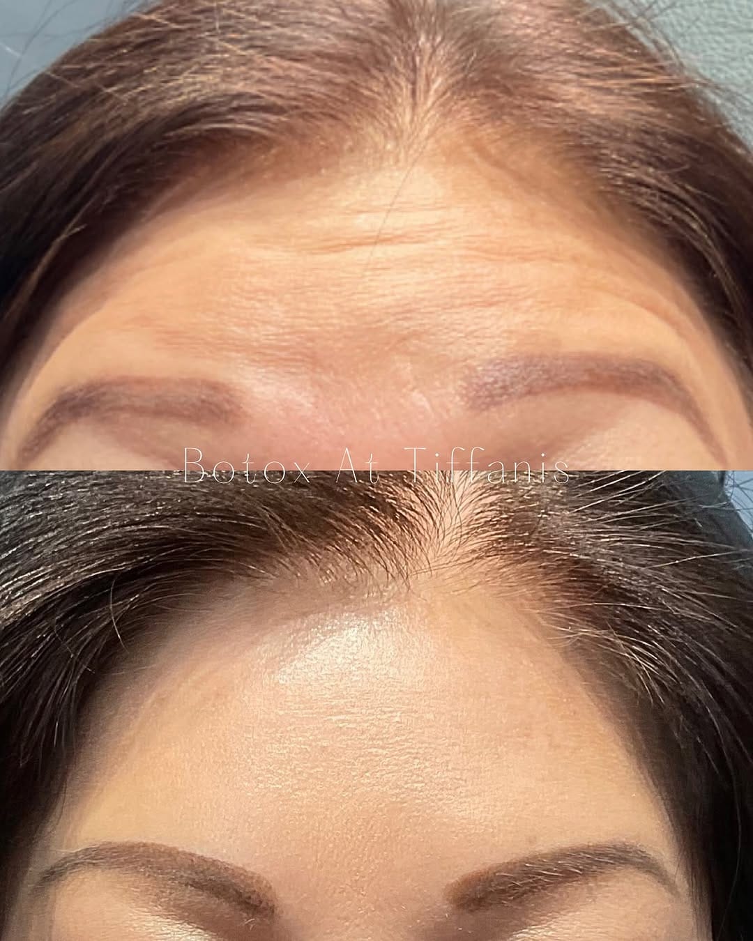 Post 8 by Tiffani Terrell, RN Injector  💋 on Instagram (image)