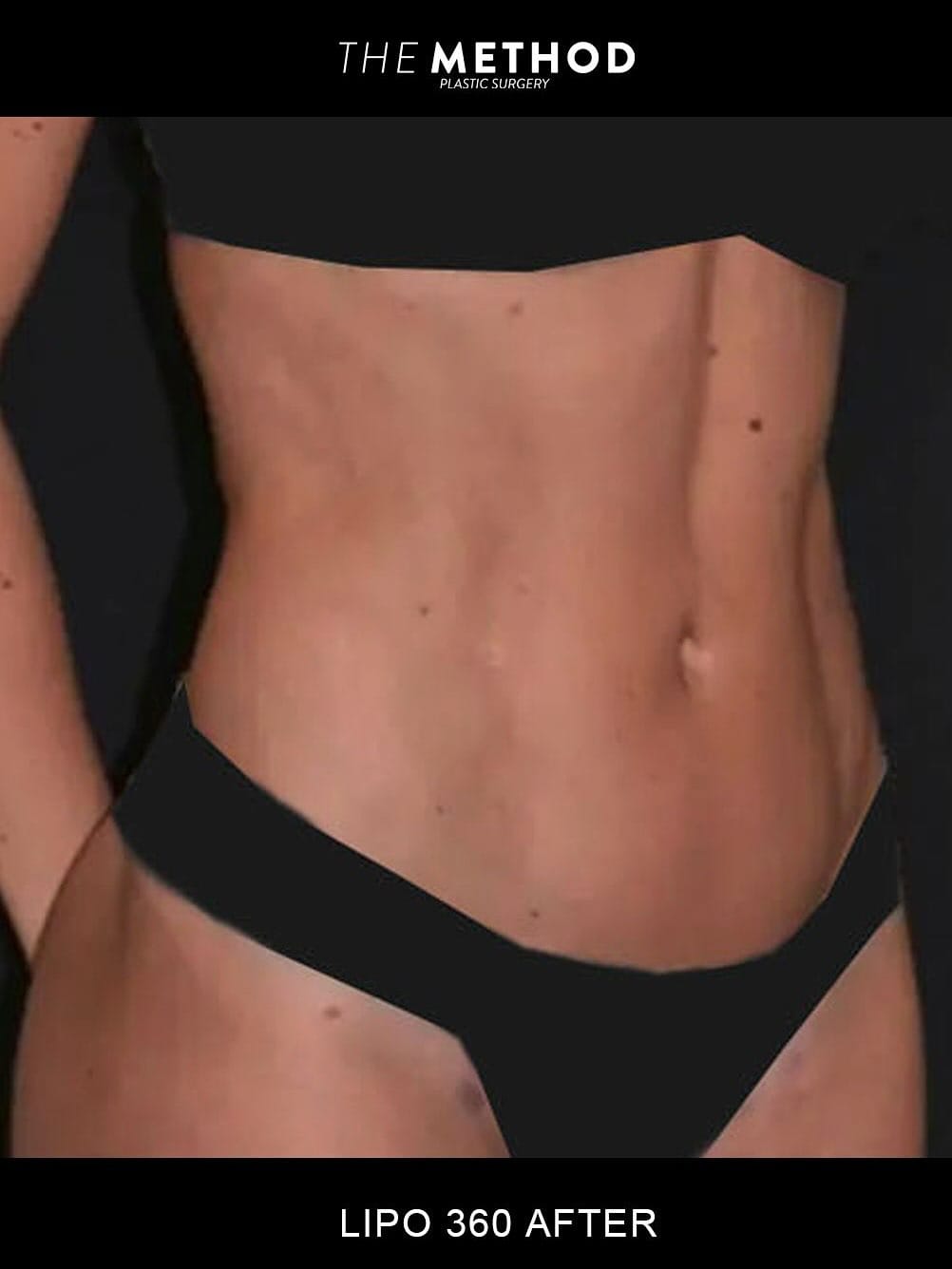 Post 7 by The Method Plastic Surgery on Instagram (carousel)