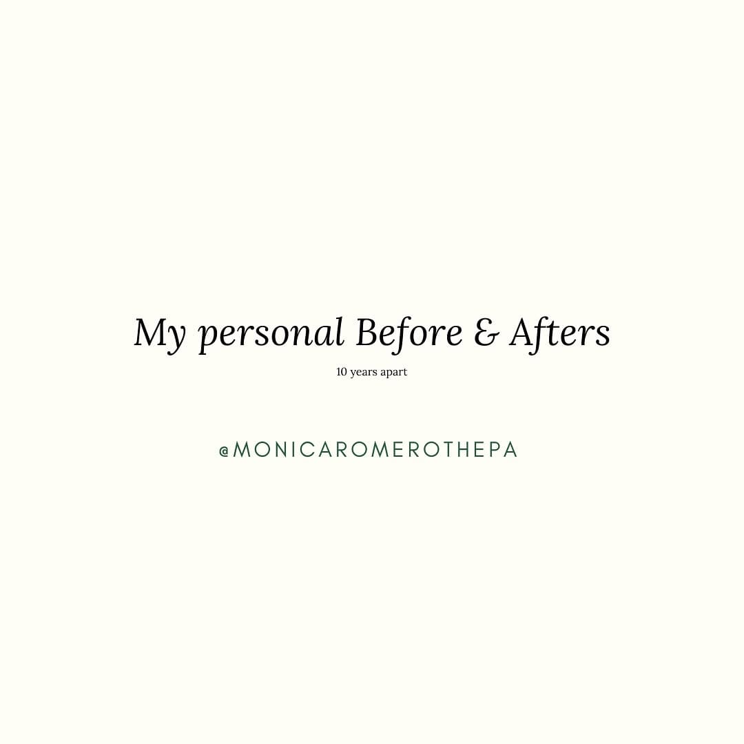 Post 8 by Monica Romero | Miami Botox + Fillers + Lasers + Skincare on Instagram (carousel)