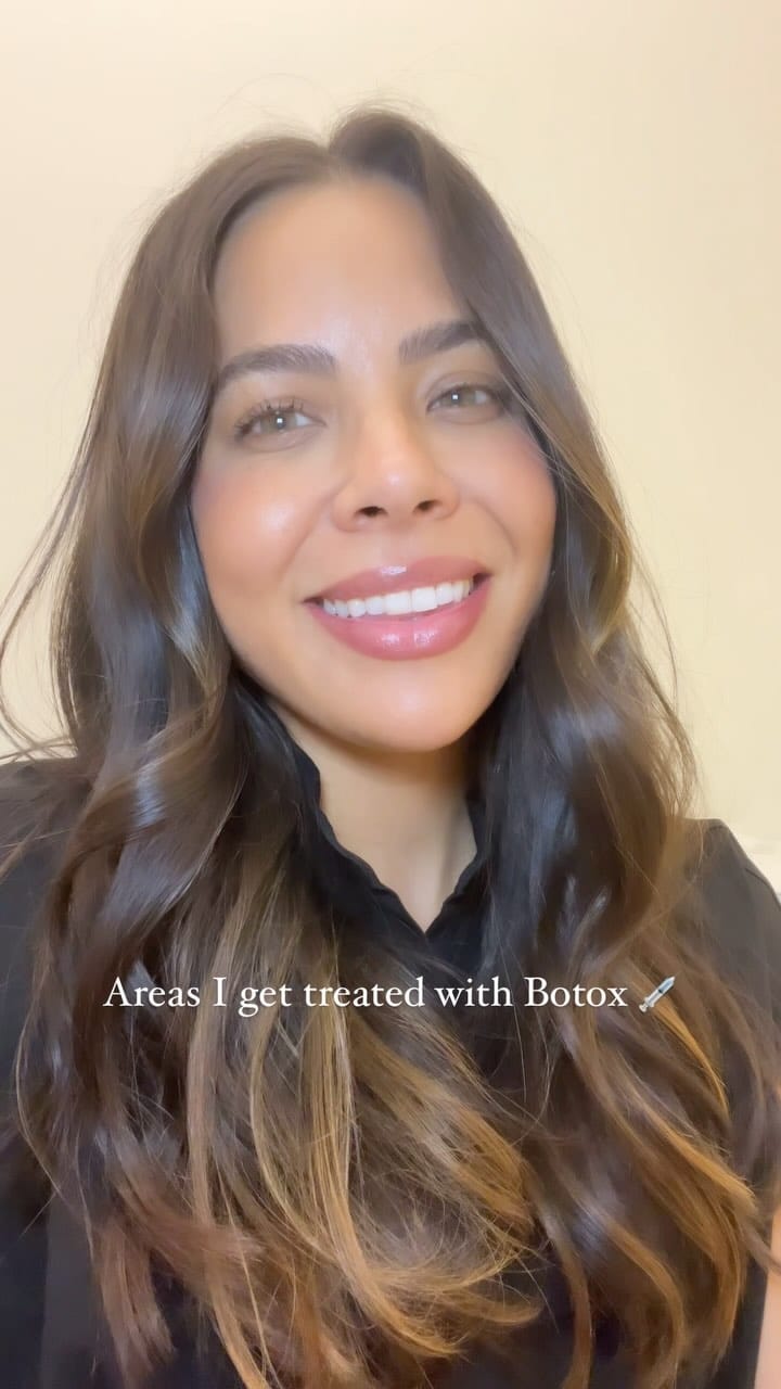 Post 10 by Monica Romero | Miami Botox + Fillers + Lasers + Skincare on Instagram (video)