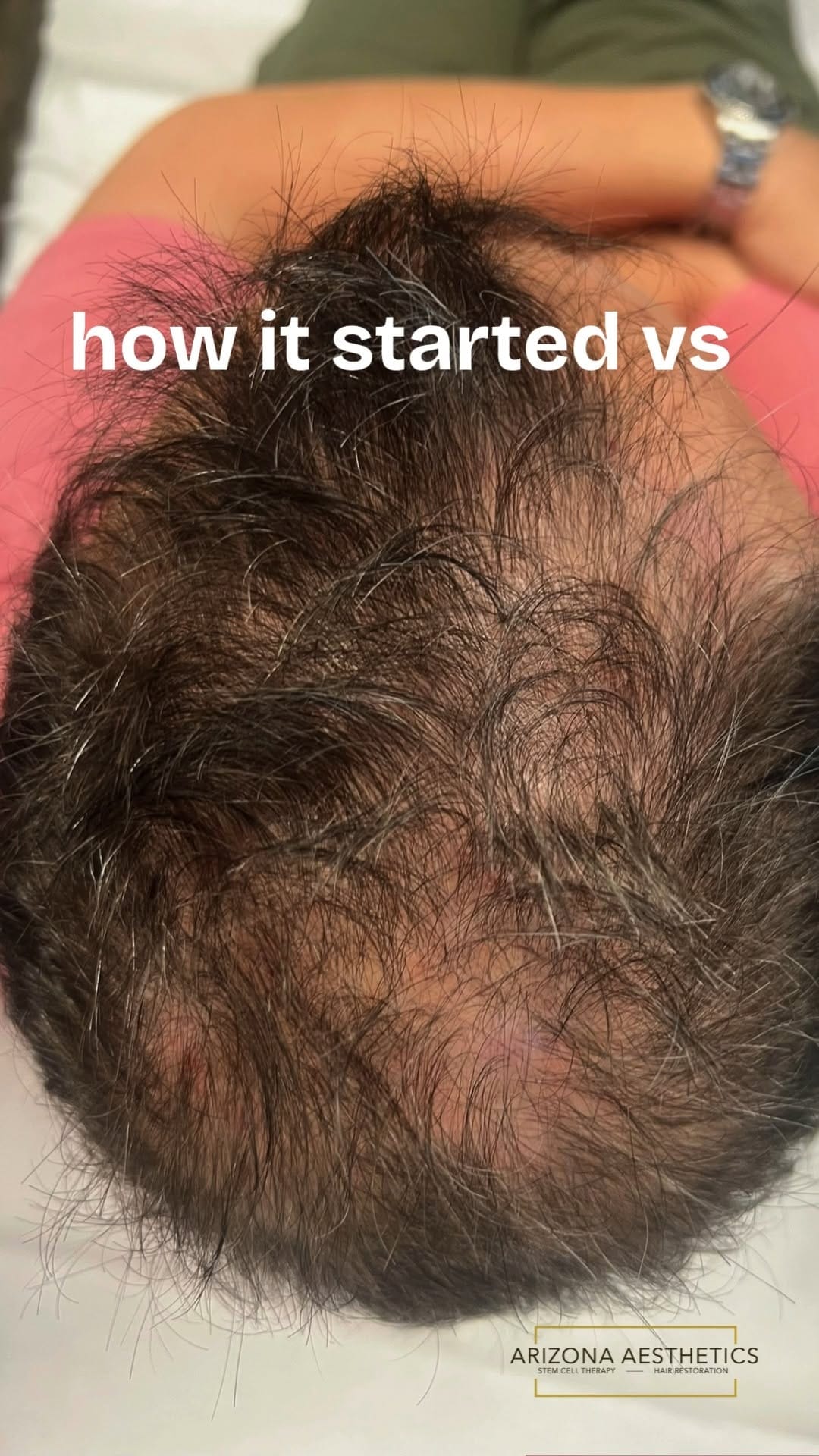 Post 7 by Arizona Aesthetics on Instagram (video)