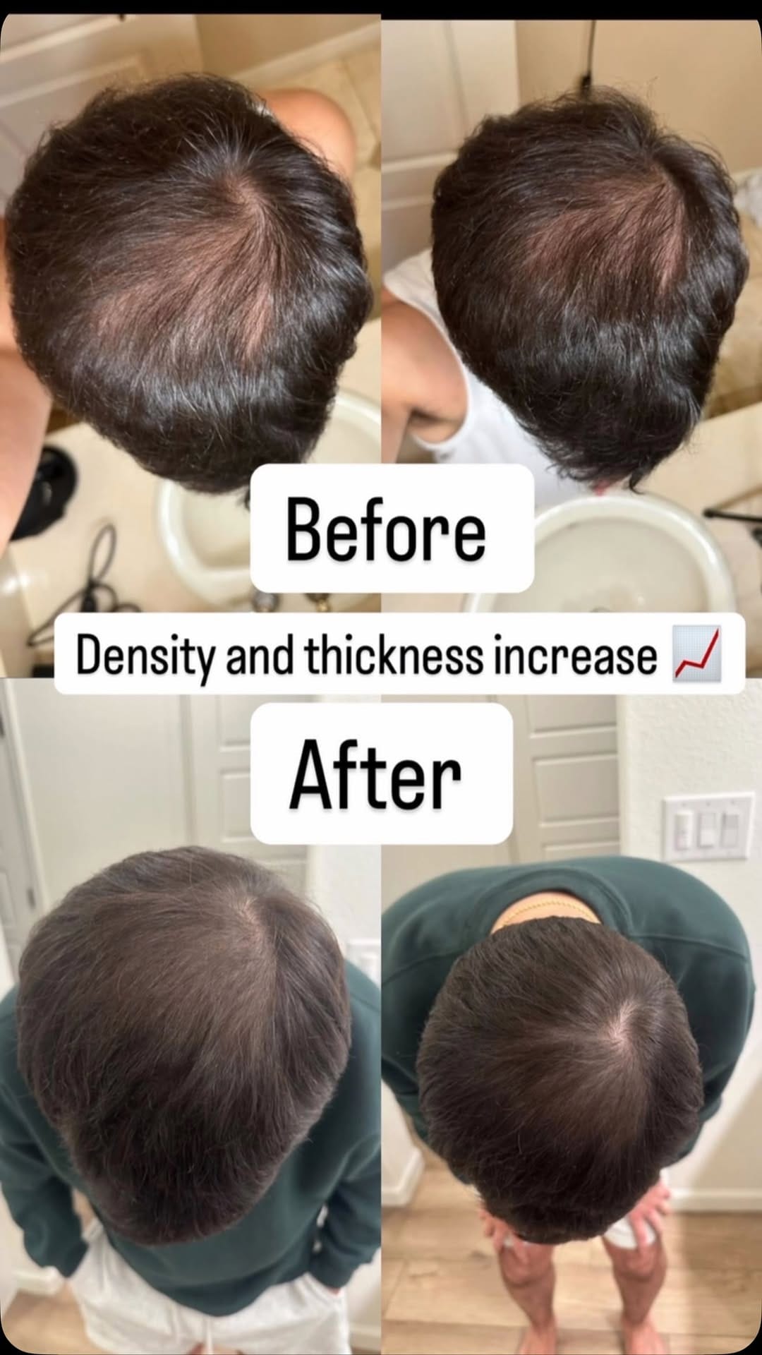 Post 9 by Hair Rescue | Solution To Hairloss on Instagram (video)