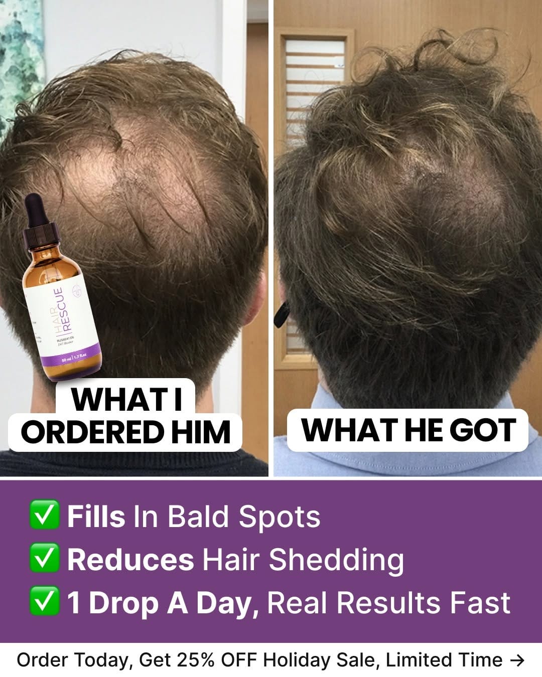 Post 5 by Hair Rescue | Solution To Hairloss on Instagram (image)