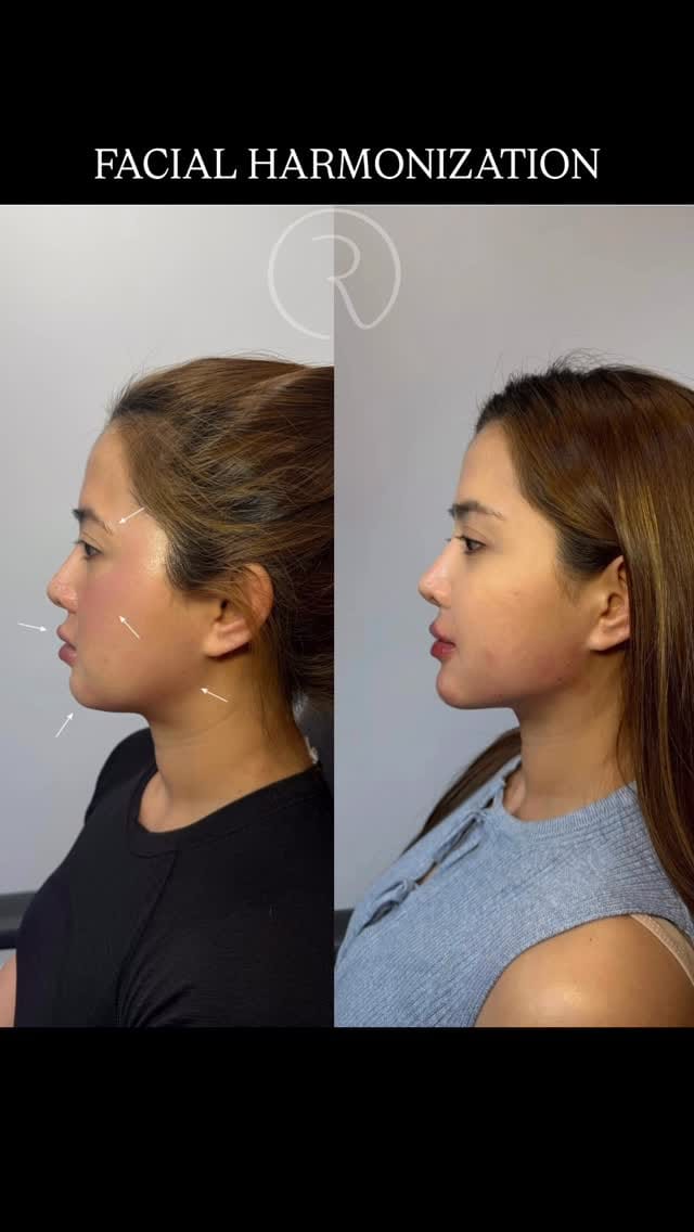 Post 3 by Dr. Elizabeth | AESTHETIC INJECTOR on Instagram (video)