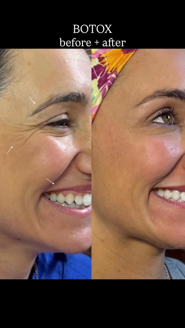 Post 8 by Dr. Elizabeth | AESTHETIC INJECTOR on Instagram (video)