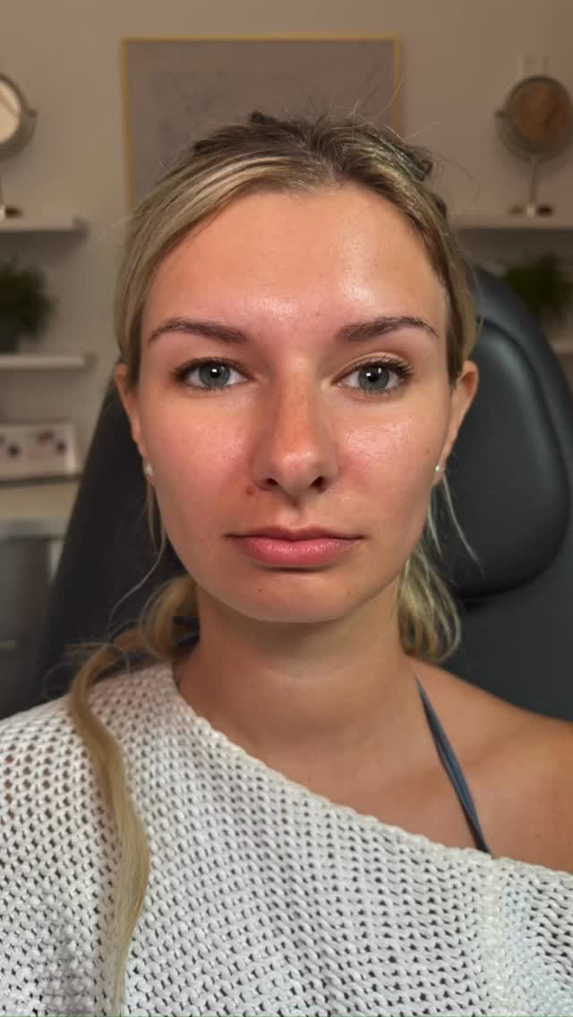 Post 1 by Dr. Elizabeth | AESTHETIC INJECTOR on Instagram (video)