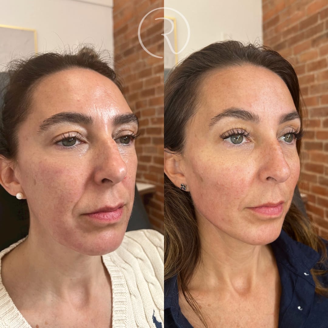 Post 10 by Dr. Elizabeth | AESTHETIC INJECTOR on Instagram (image)