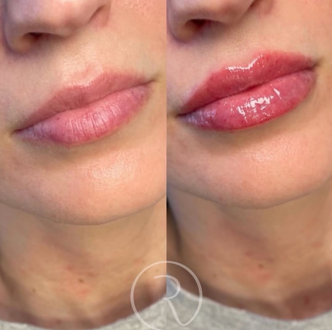 Post 2 by Dr. Elizabeth | AESTHETIC INJECTOR on Instagram (image)