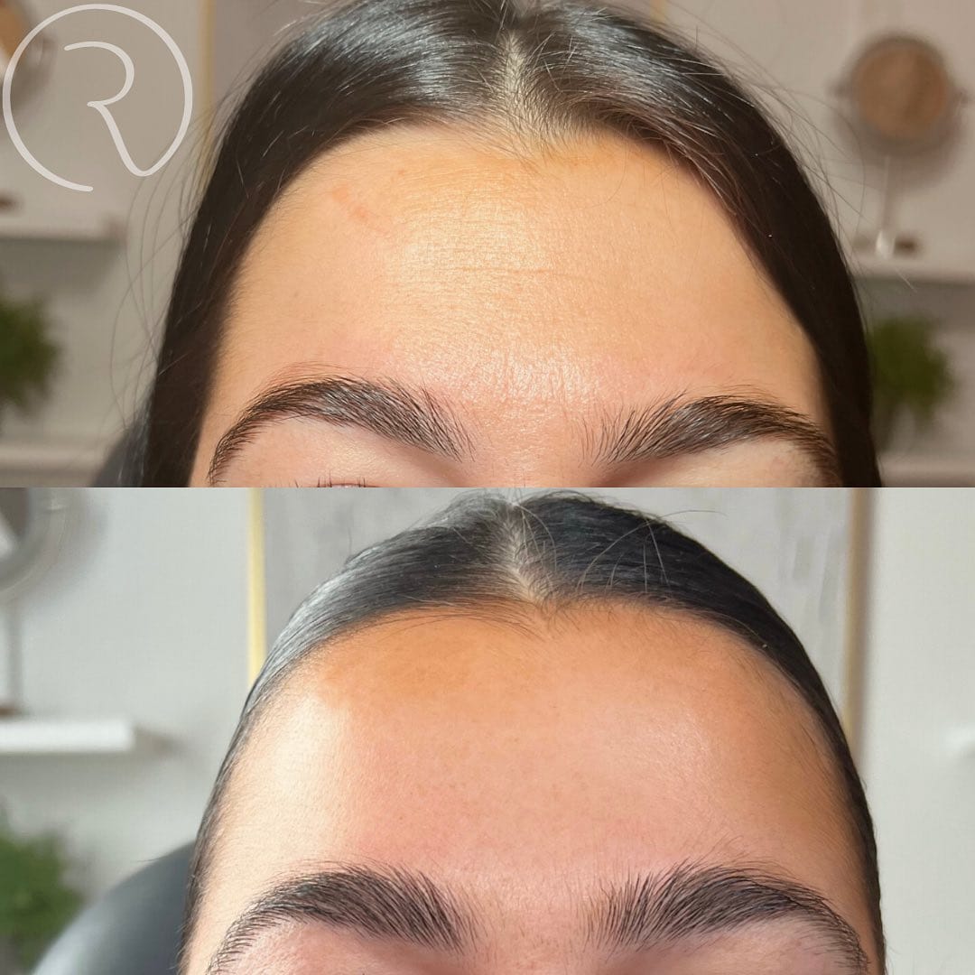 Post 9 by Dr. Elizabeth | AESTHETIC INJECTOR on Instagram (carousel)