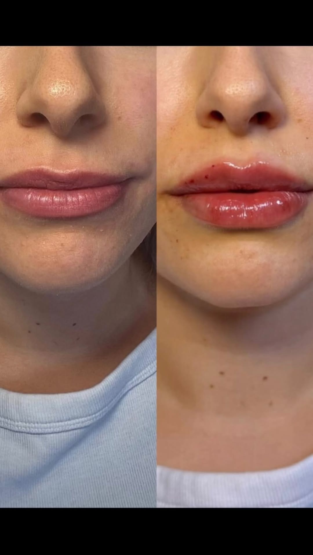 Post 6 by Dr. Elizabeth | AESTHETIC INJECTOR on Instagram (video)