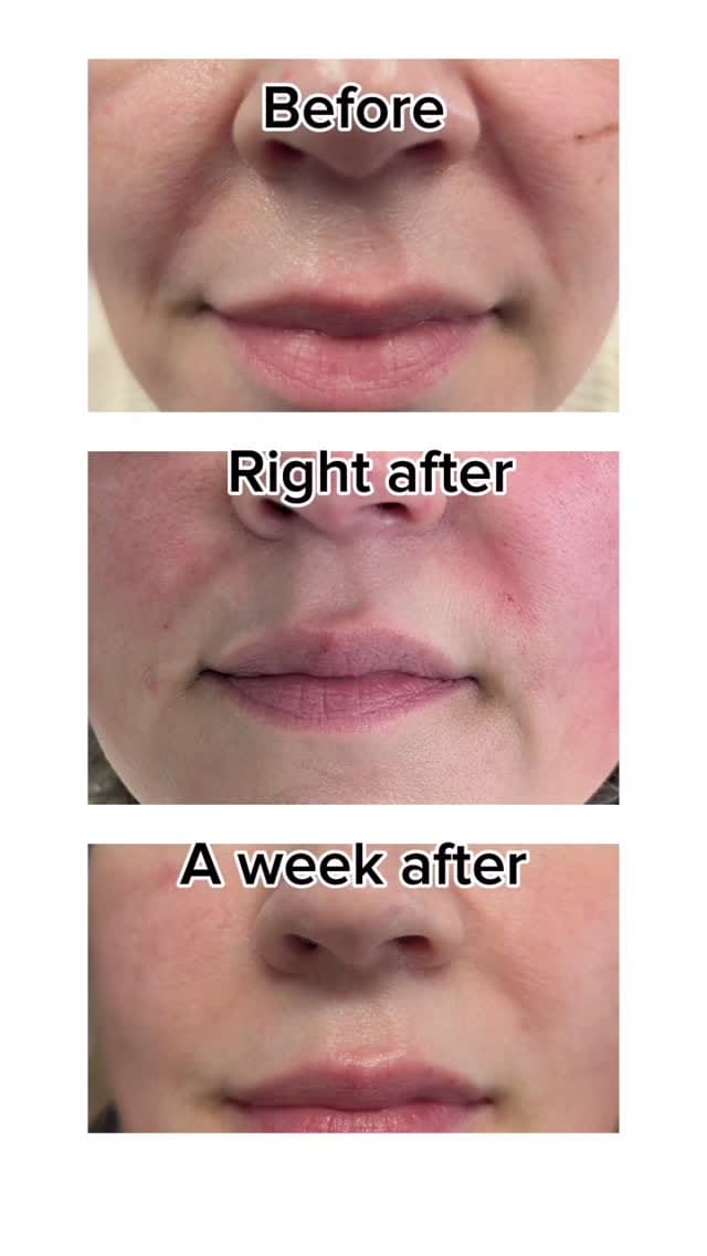 Post 5 by Rejina Shrestha Permanent Makeup Artist👩🏻‍🎨and Educator🎓 on Instagram (video)