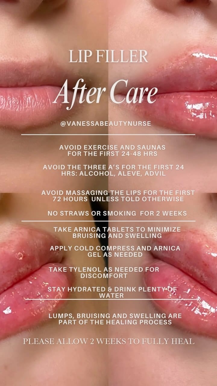 Post 10 by Vanessa Mondragon BSN, RN | Dallas Injector on Instagram (video)
