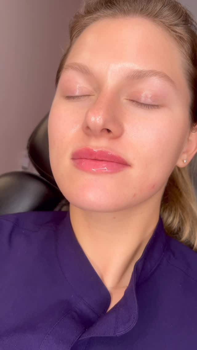 Post 9 by Vanessa Mondragon BSN, RN | Dallas Injector on Instagram (video)