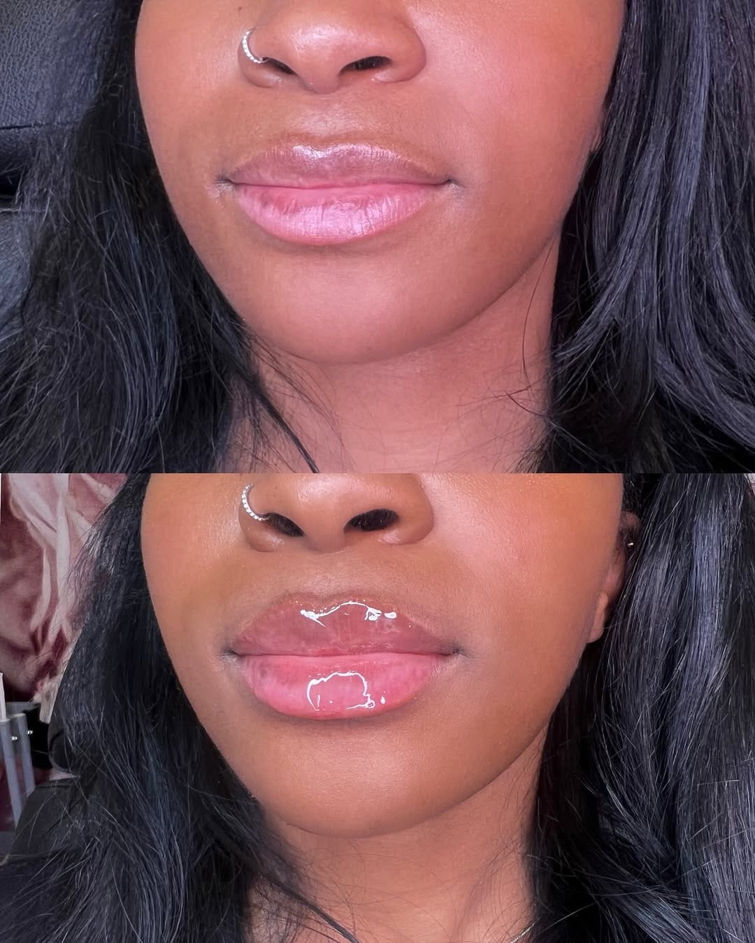Post 3 by Vanessa Mondragon BSN, RN | Dallas Injector on Instagram (image)