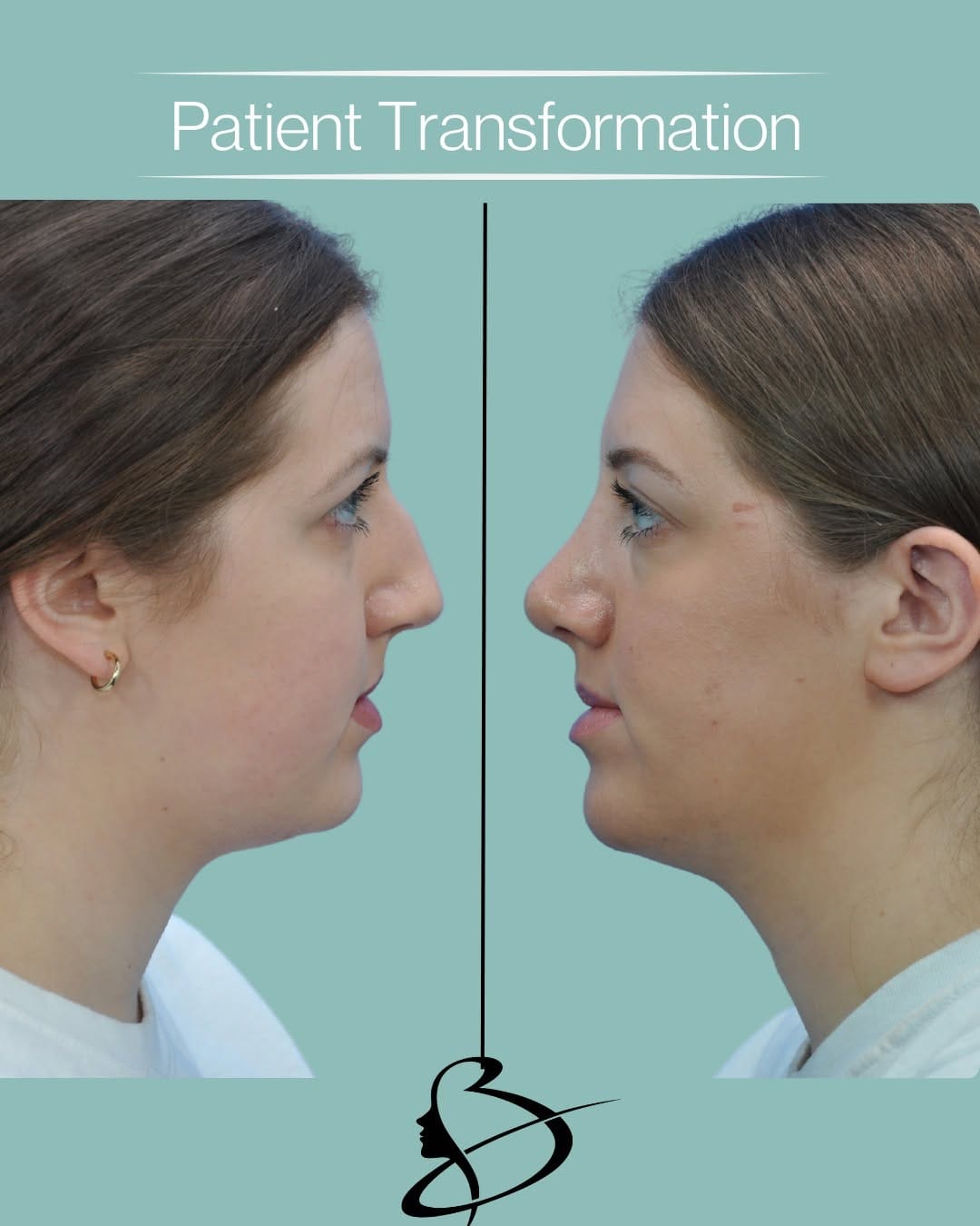 Post 1 by Mark Beaty, MD | Facelift | Rhinoplasty | Botox | Filler | Laser on Instagram (carousel)