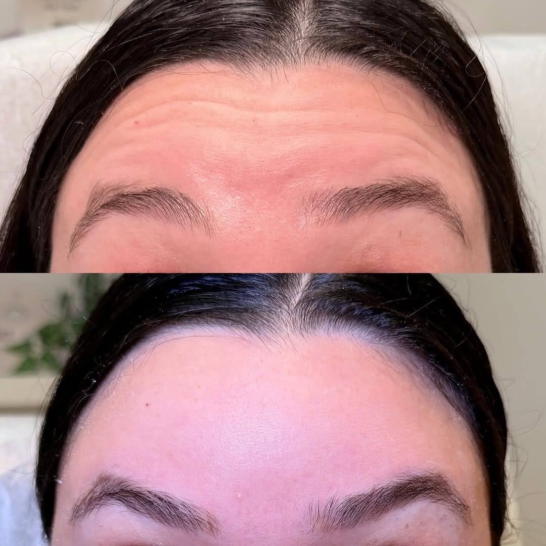 Post 1 by Botoxie Med Spa 💉🫧 on Instagram (carousel)