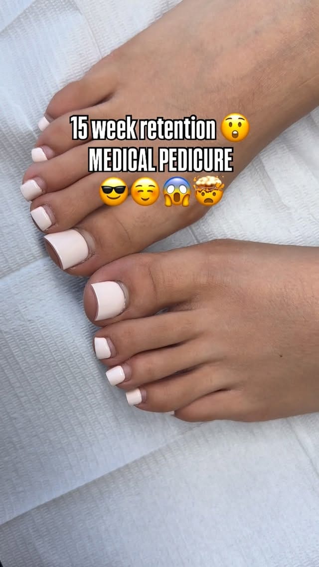 Post 6 by DTLA FUNGAL TOE SPECIALIST💅🏻 on Instagram (video)