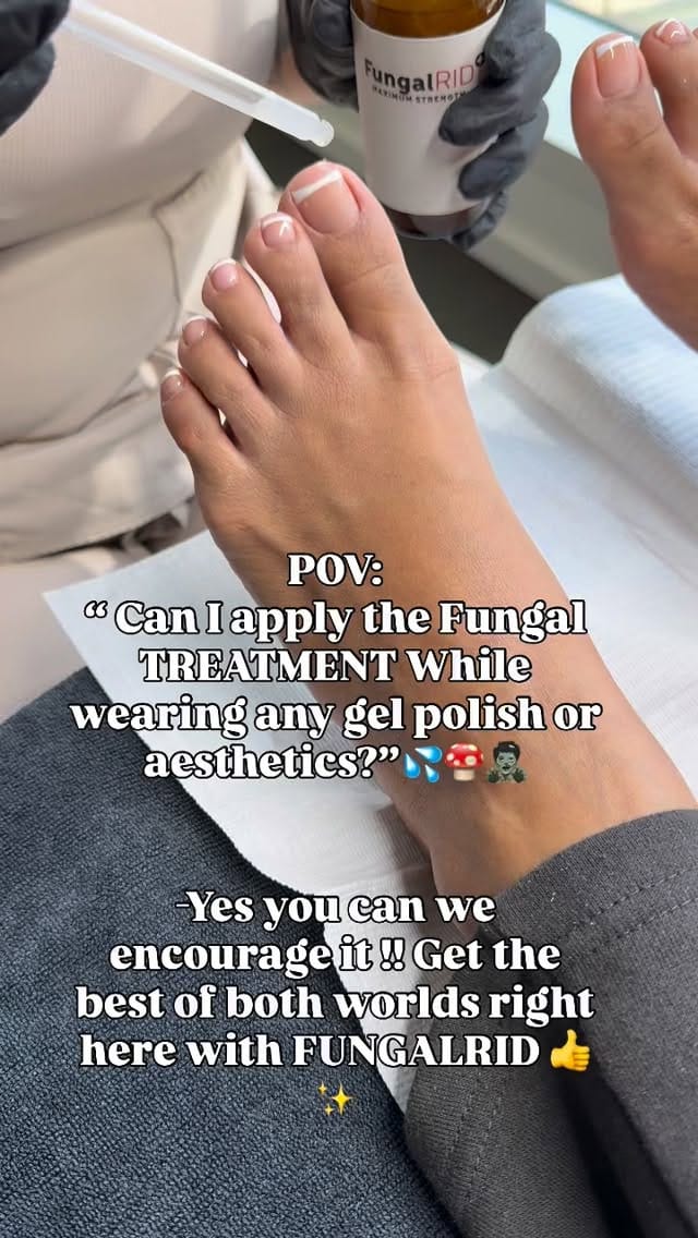 Post 3 by DTLA FUNGAL TOE SPECIALIST💅🏻 on Instagram (video)