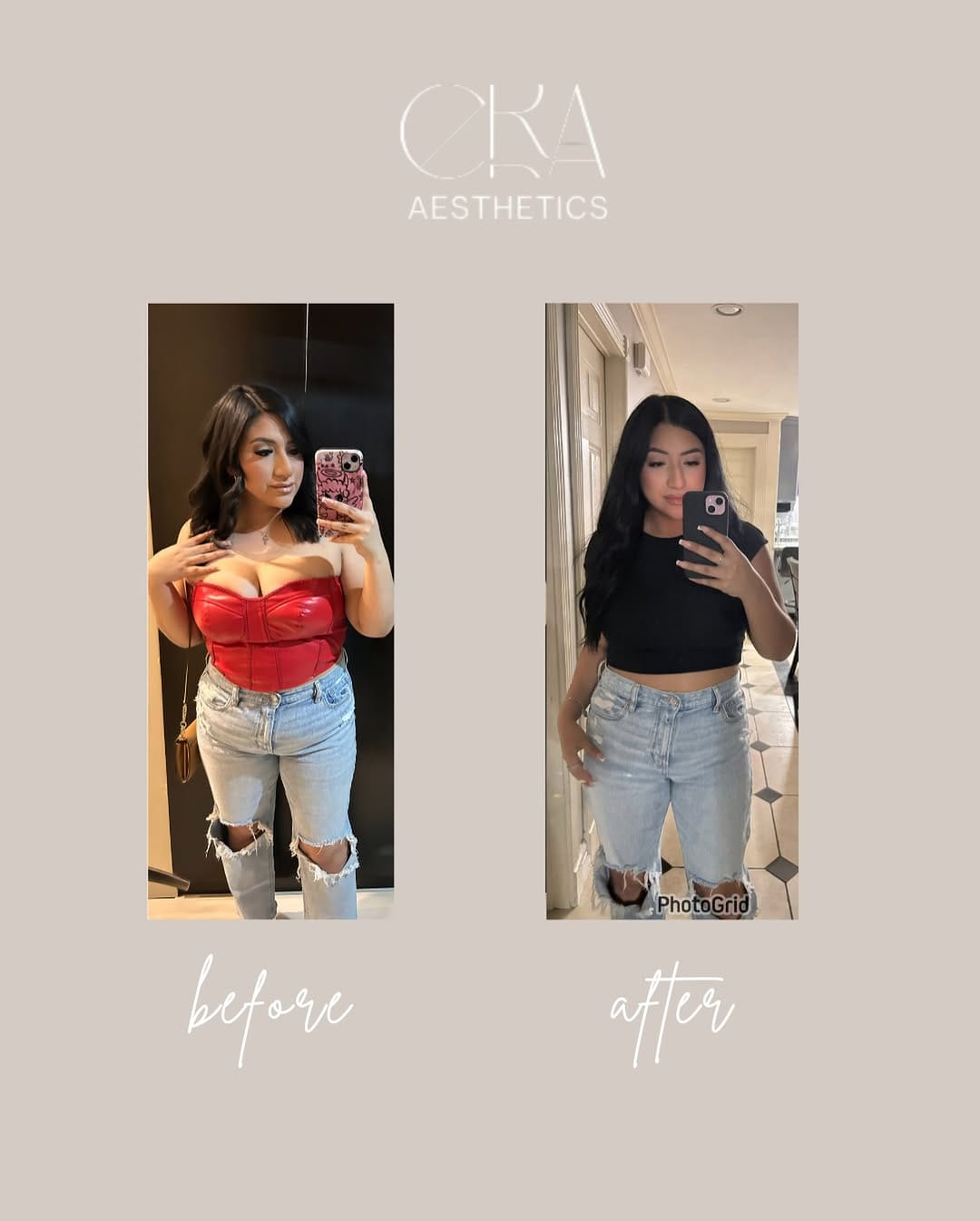Post 6 by 𝙼𝚒𝚌𝚛𝚘𝚋𝚕𝚊𝚍𝚒𝚗𝚐 𝙷𝚘𝚞𝚜𝚝𝚘𝚗 on Instagram (image)