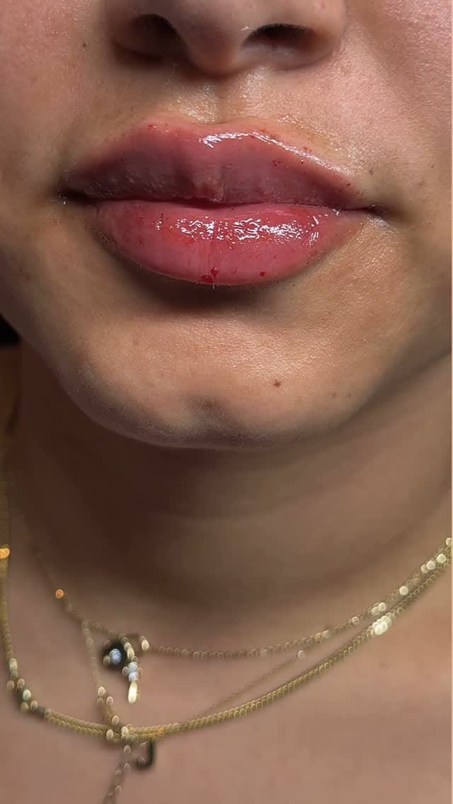 Post 8 by Nurse Heidi 💋 on Instagram (video)