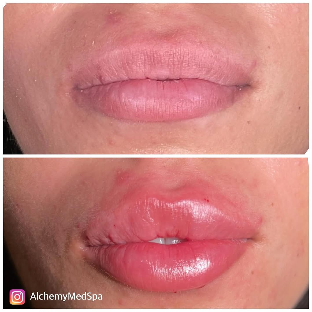 Post 5 by Nurse Heidi 💋 on Instagram (image)