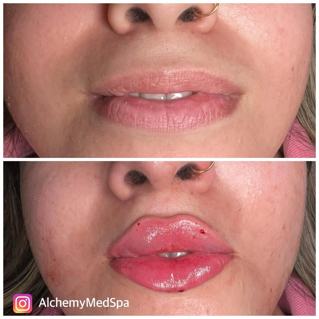 Post 9 by Nurse Heidi 💋 on Instagram (image)