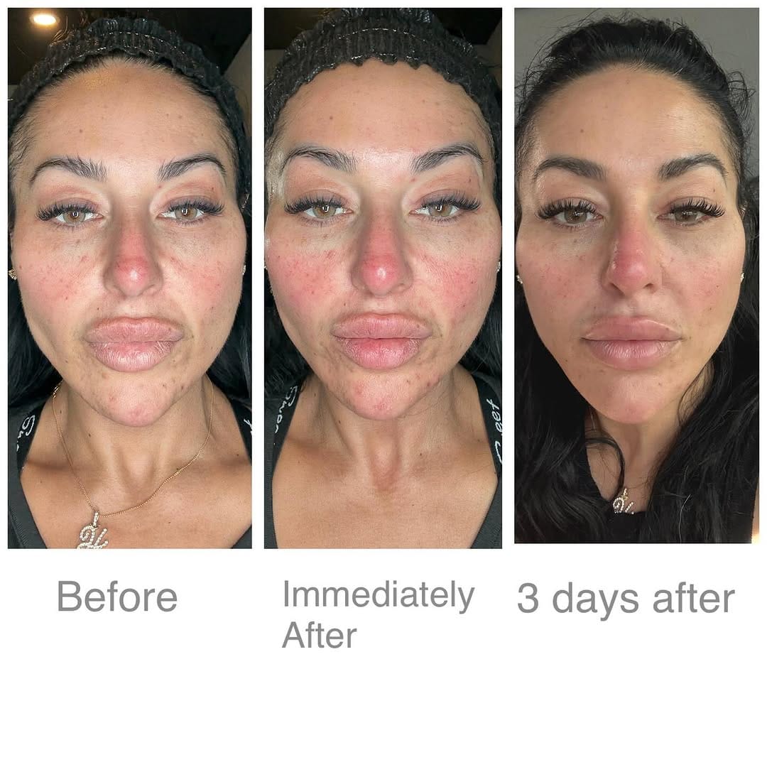 Post 2 by Nurse Heidi 💋 on Instagram (image)