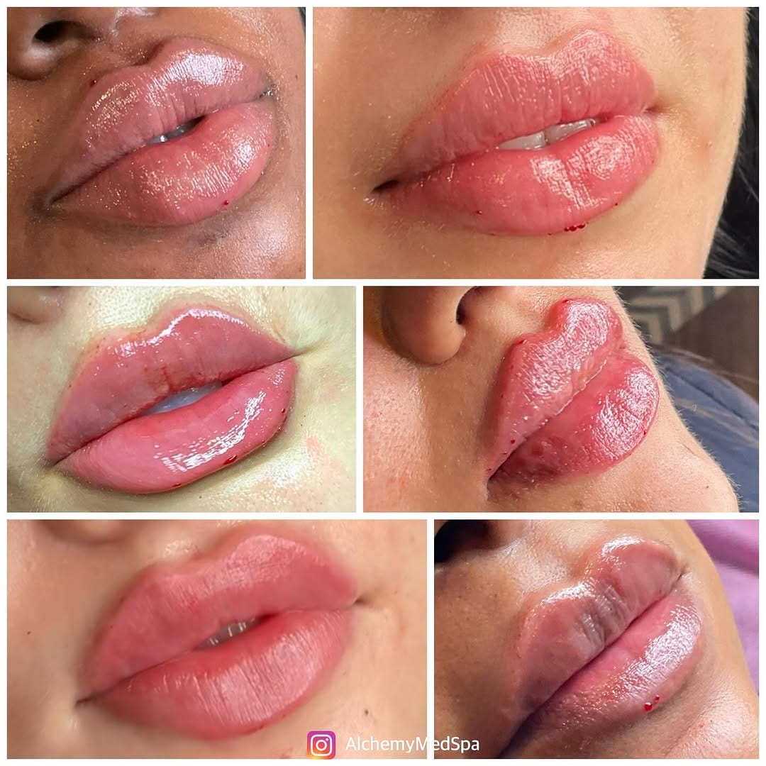 Post 1 by Nurse Heidi 💋 on Instagram (image)