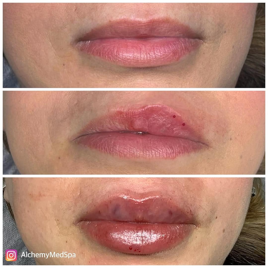 Post 7 by Nurse Heidi 💋 on Instagram (image)