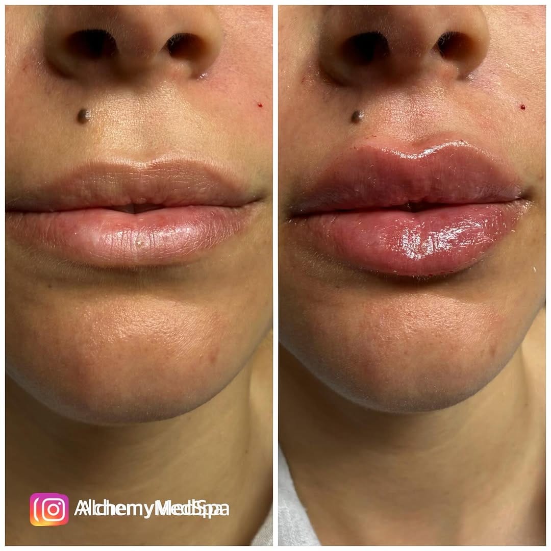 Post 3 by Nurse Heidi 💋 on Instagram (carousel)