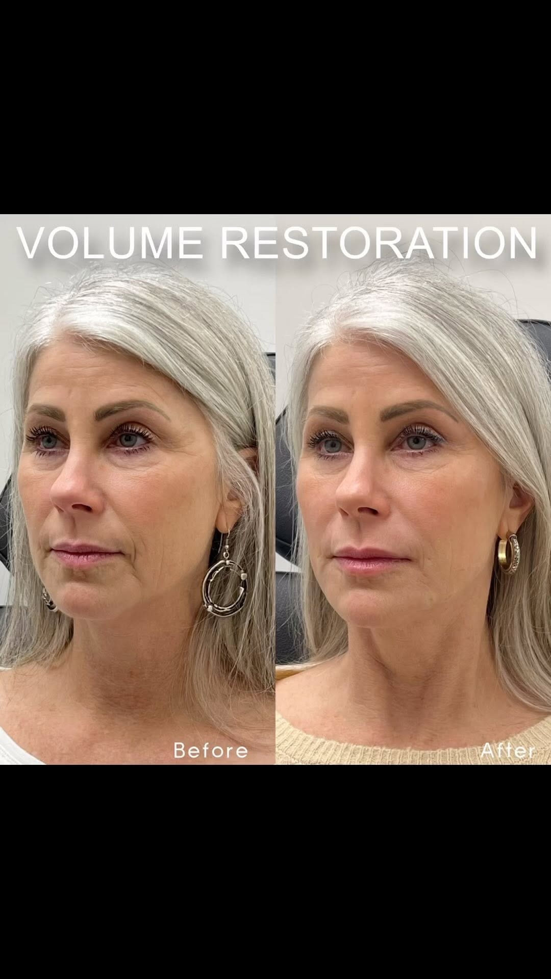 Post 8 by PINKY ELLIOTT, RN, BSN on Instagram (video)