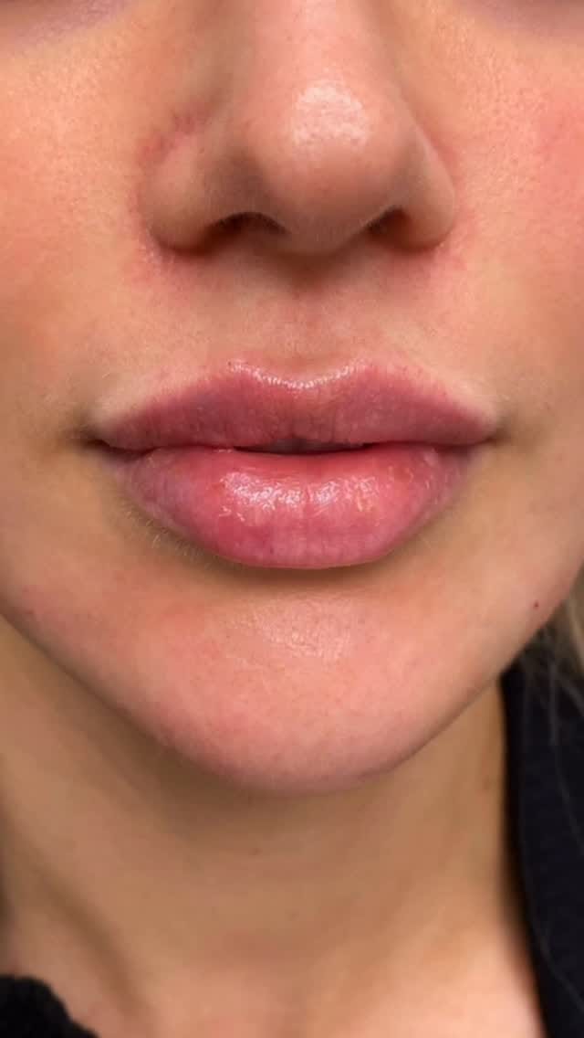 Post 5 by PINKY ELLIOTT, RN, BSN on Instagram (video)