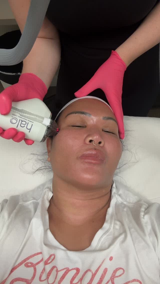 Post 6 by Audi, RN, CANS| Skin Spirit on Instagram (video)