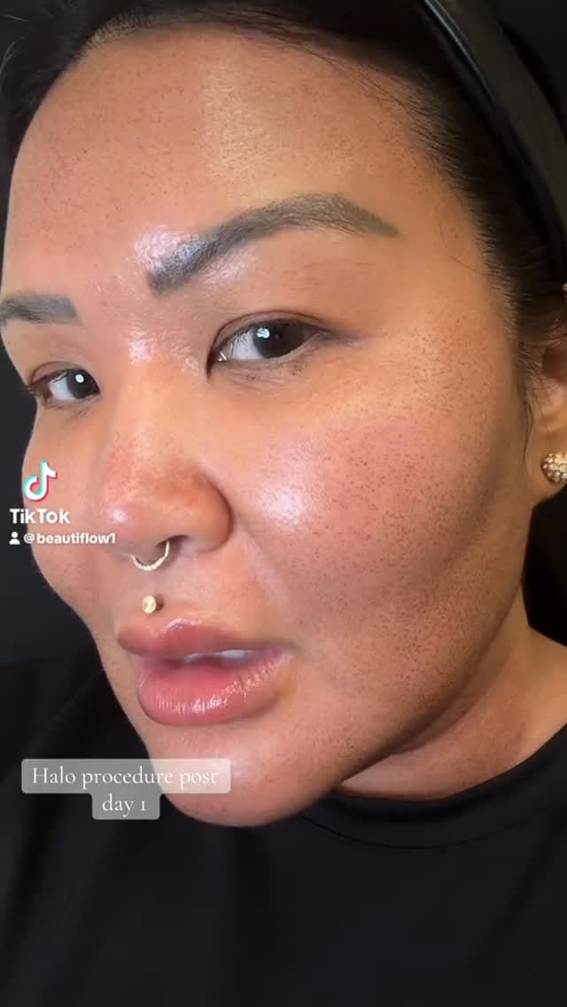 Post 5 by Audi, RN, CANS| Skin Spirit on Instagram (video)
