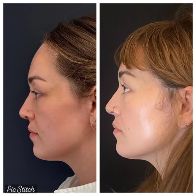 Post 9 by Audi, RN, CANS| Skin Spirit on Instagram (video)
