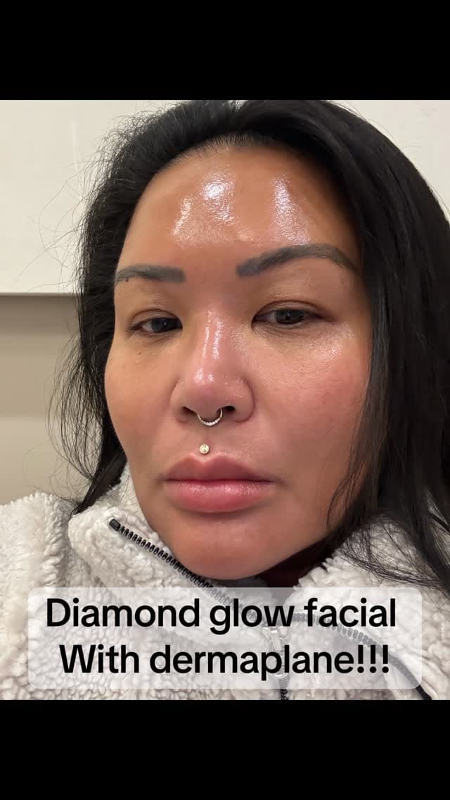 Post 7 by Audi, RN, CANS| Skin Spirit on Instagram (video)