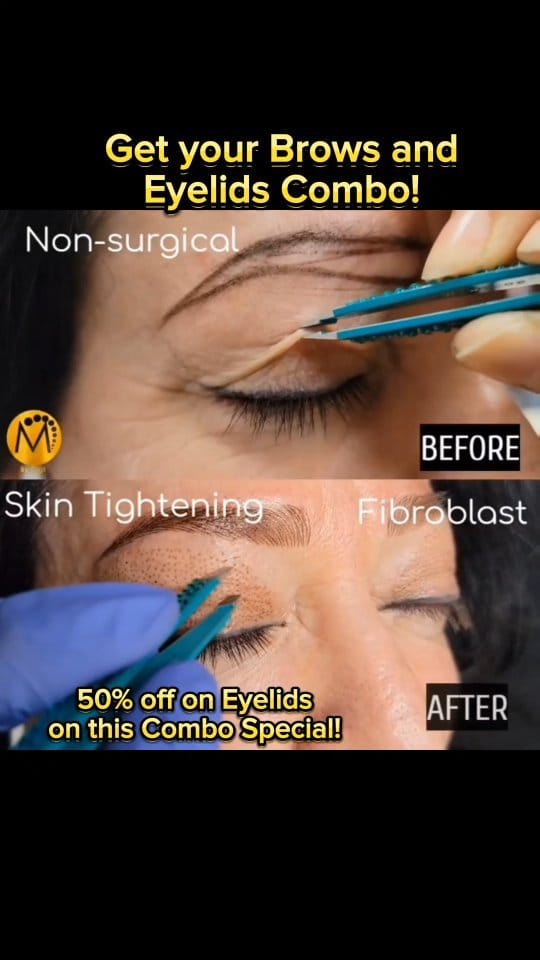 Post 9 by “GIGI MEDINA” MICROBLADING, FIBROBLAST & ACADEMY on Instagram (video)