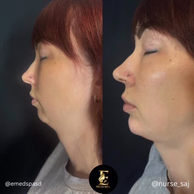 Post 5 by Ve Simone, MSN, RN, LE on Instagram (video)
