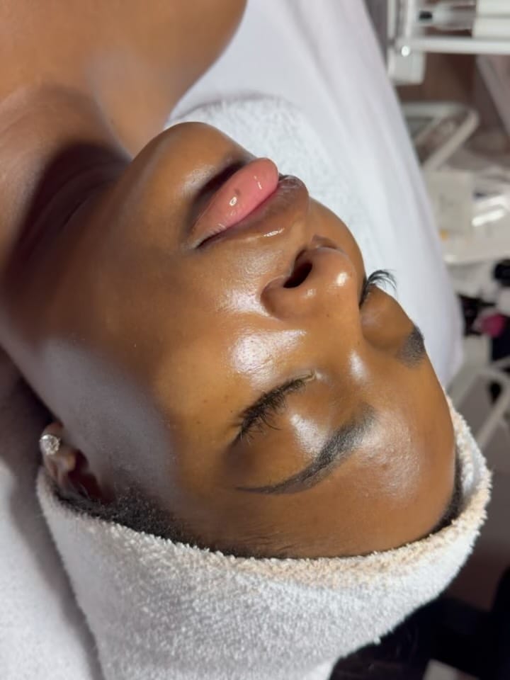 Post 1 by THE HOUSTON ESTHETICIAN on Instagram (carousel)