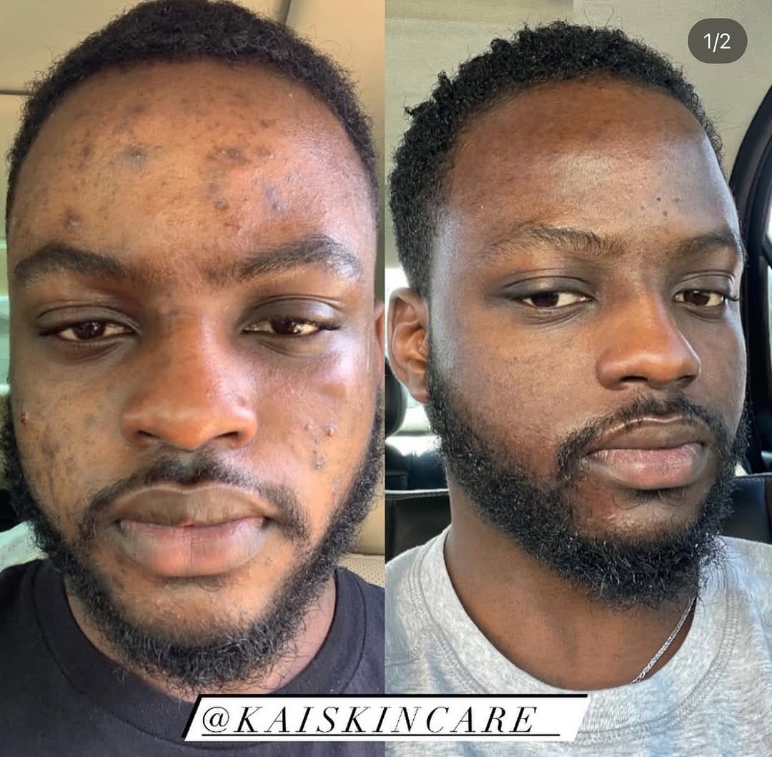 Post 10 by THE HOUSTON ESTHETICIAN on Instagram (carousel)