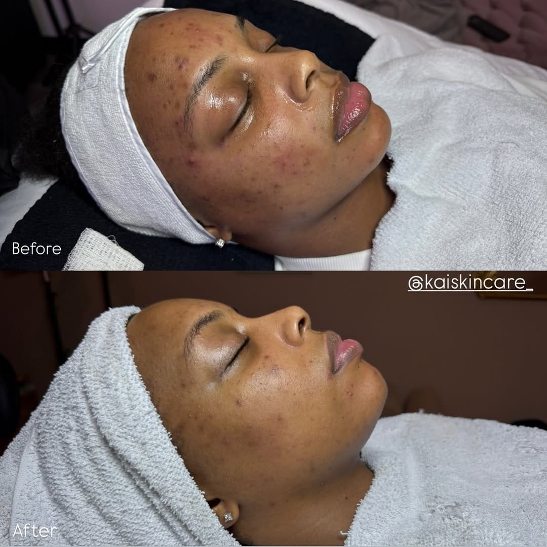 Post 7 by THE HOUSTON ESTHETICIAN on Instagram (carousel)