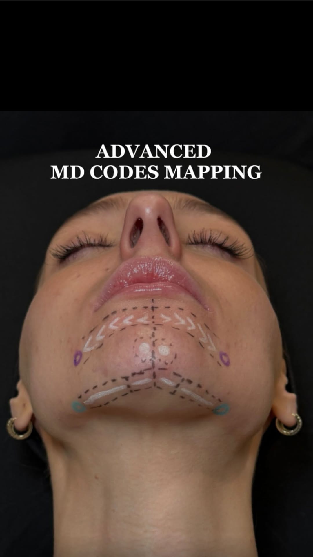Post 1 by Riley Worth Henrichsen APRN, MSN, FNP-C, FNP-BC on Instagram (video)
