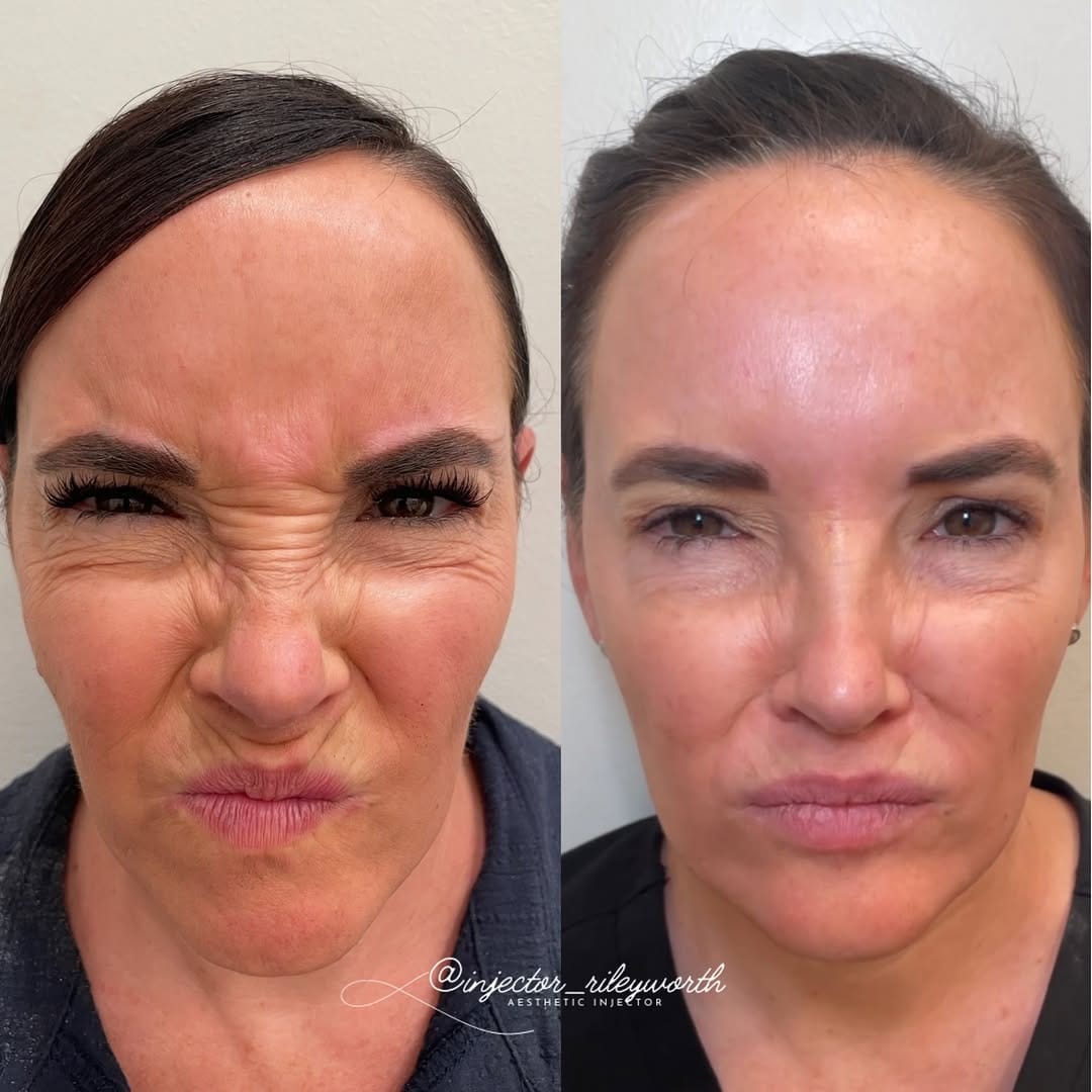 Post 6 by Riley Worth Henrichsen APRN, MSN, FNP-C, FNP-BC on Instagram (image)